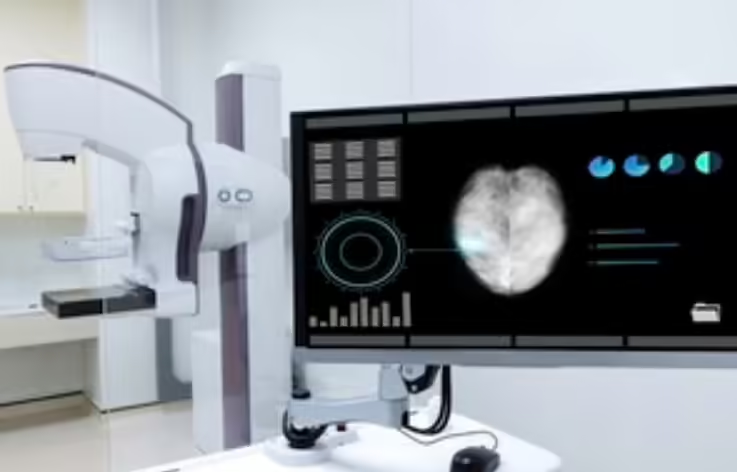 英国启动 70 万人全球最大规模乳腺癌 AI诊断实验，有望解放数百名医生 - 兰州联臻能源网